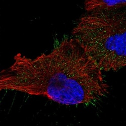 UBASH3B/STS1/Tula-2 Antibody, Novus Biologicals:Antibodies:Primary Antibodies